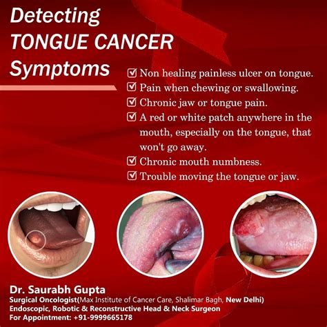 Dr Saurabh Gupta Oncologist October 2019