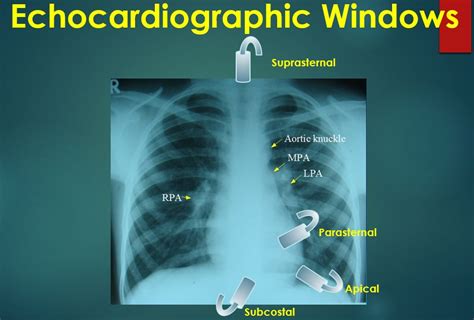 Basic Echocardiographic Views All About Cardiovascular System And