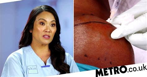 Dr Pimple Popper Removes Huge Neck Bump From Patient In Series Three