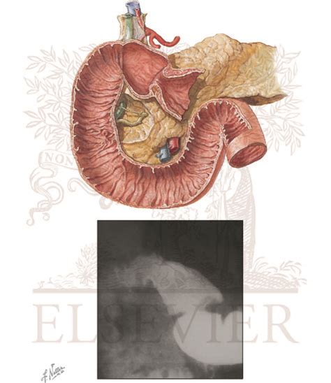 Duodenal Bulb Anatomy