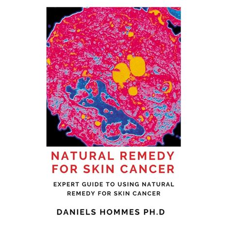 Natural Remedy For Skin Cancer Everything You Need To Know About Skin