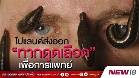 เดอะเบสท์ แนะแนวเรียนต่อต่างประเทศครบวงจร เรียนต่อยุโรป | 10 เหตุผล ทำไมควรเลือกเรียนต่อโปแลนด์ ประหยัดค่าใช้จ่ายจริงไหม ทำงานระหว่างเรียน. โปแลนด์ส่งออก"ทากดูดเลือด"เพื่อการแพทย์ (คลิป)