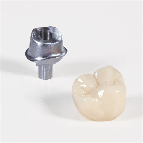 Dental Implant Restorations Stldental Design Center