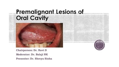 Oral Potentially Malignant Disorders Ppt