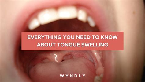 swollen tongue causes symptoms and treatment 2024 and wyndly