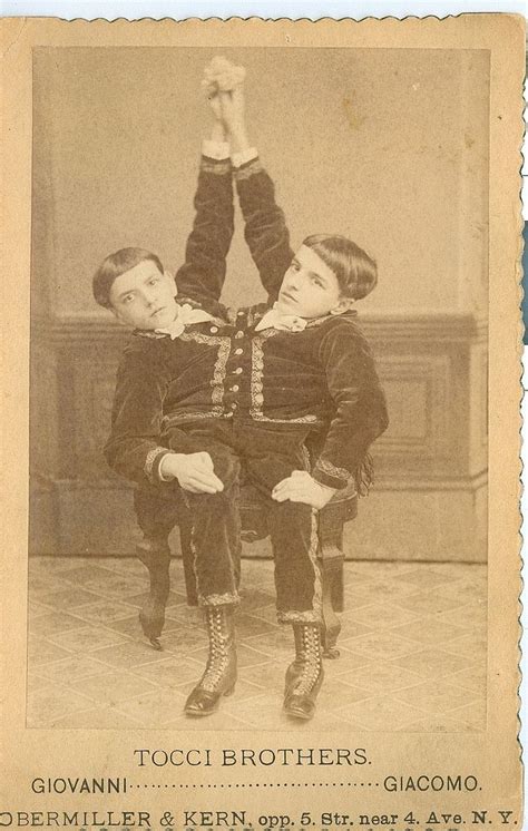 Tocci Brothers Siamese Twins Vintage Pictures Old Pictures Old Photos Old Circus Vintage