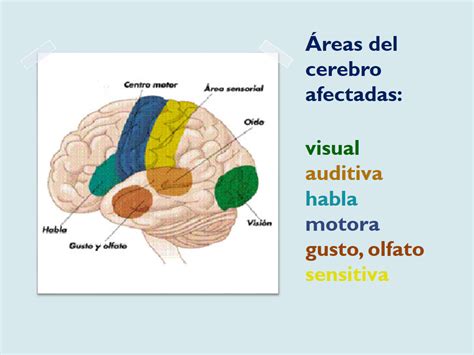 Proyecto De Investigaci N Salud Par Lisis Cerebral
