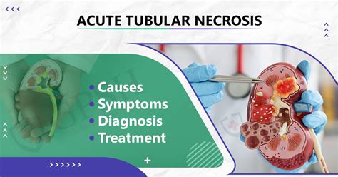 Acute Tubular Necrosis Causes Symptoms Diagnosis And Treatment