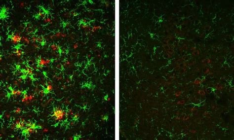 researchers successfully reverse alzheimer s disease in mouse model