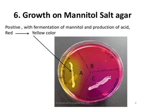 Gram Positive Bacteria On Mannitol Salt Agar Plate Microbiology