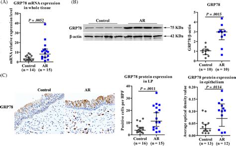 grp78 mrna and protein expressions are enhanced in nasal tissues in ar download scientific