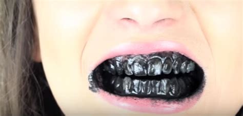 Here S Why Some People Are Brushing Their Teeth Black And Why It S Really Not A Good Idea