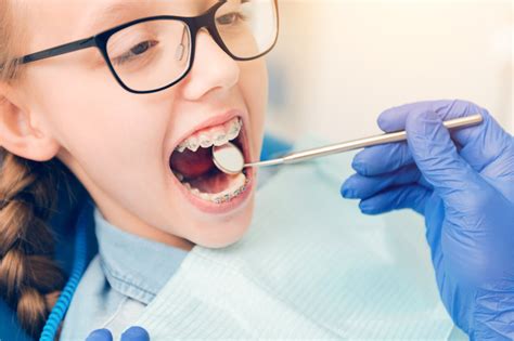 All You Need To Know About Early Orthodontic Treatment Pros And Cons