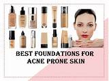 Best Makeup For Combination Acne Prone Skin Images