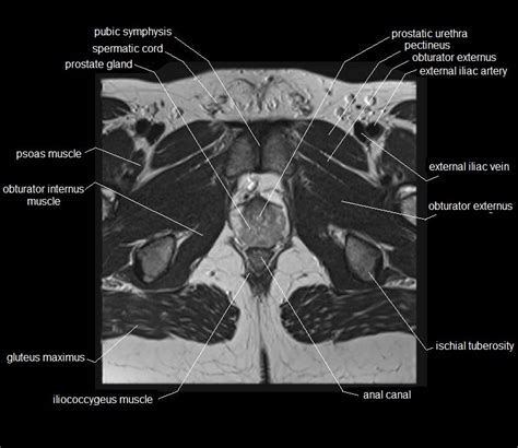 Structural and functional anatomy of the pelvis. MRI pelvis anatomy | free male pelvis axial anatomy