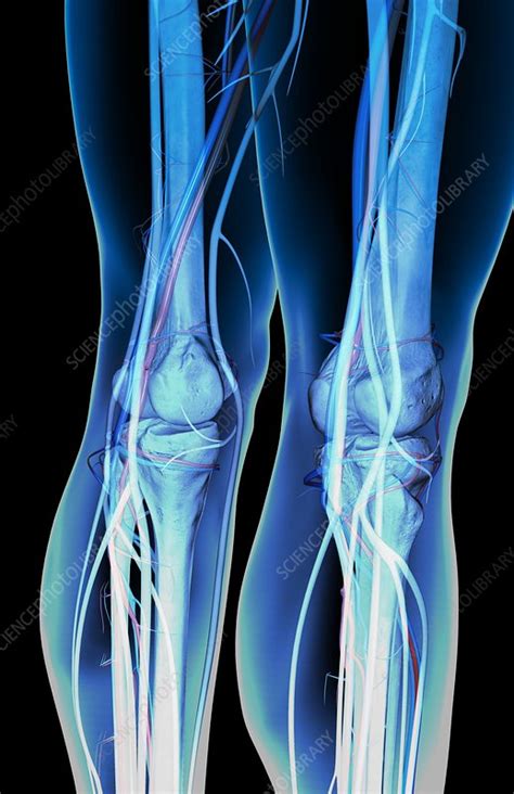 The Blood Vessels Of The Leg Stock Image C0082665 Science Photo