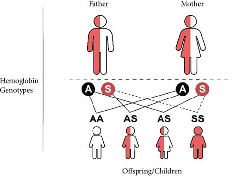 Inheritance Of Sickle Cell Disease In A Scenario Where Both Parents