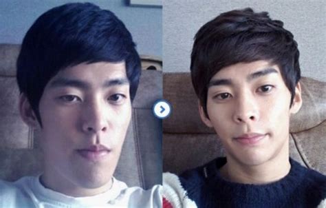 Many people experience constipation after surgery. Crazy Before And After Photos Of South Korean Plastic Surgery - Page 3 - Sick Chirpse