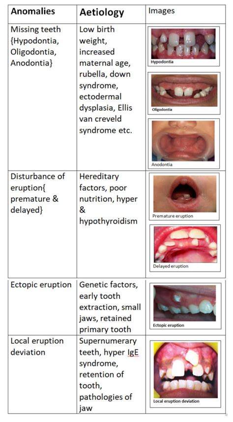 Eruption Sequence Of Tooth Focus Dentistry