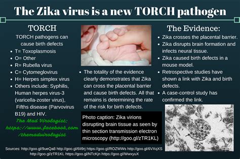 The Mad Virologist Zika Causes Birth Defects Another Case Of Moms