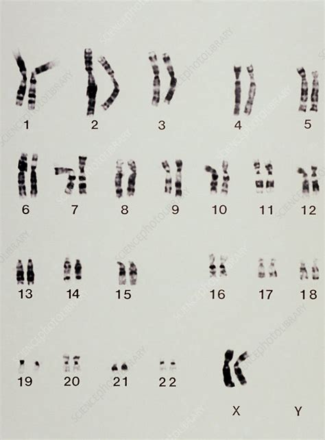 Karyotype Showing Arrangement Of Chromosomes Stock Image M3520004
