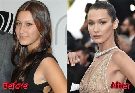 Bella hadid, one of the most discussed and popular models, is recently observed and talked about whereas, for some before was better and for others the after was better. Pin di Monia Sinopoli su random | Bellezza, Natura