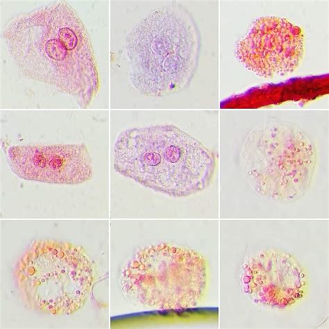Células Epiteliales en orina Grupo Zoovet