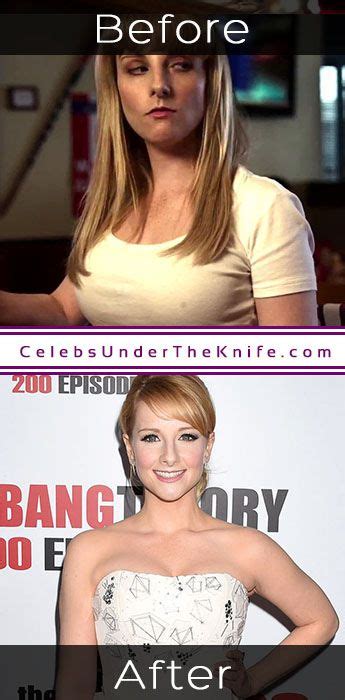 Melissa Rauch Breast Reduction Did The Big Bang Star S Boobs Get Smaller
