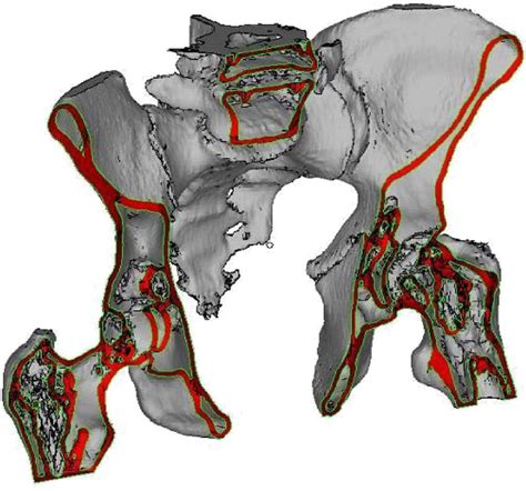 From wikimedia commons, the free media repository. Project of pelvic bones model. a) cross-section of 4 mm ...