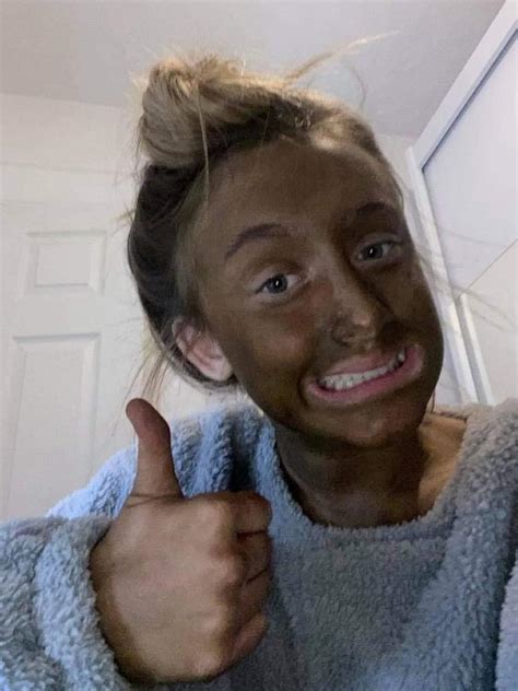 Teen Girl Shares Hilarious Ultra Dark Tanning Mistake Photos Daily