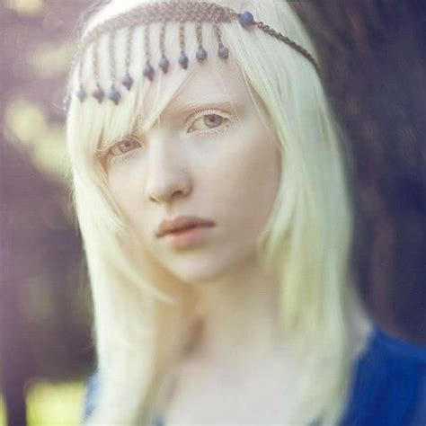 Nastya Kumarova Albino Model Female Character Inspiration Albinism
