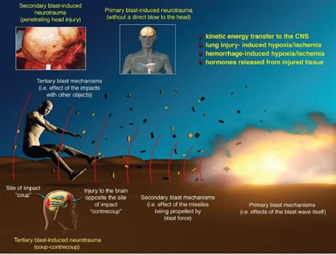 3 Pathophysiology Of Blast Injury And Overview Of Experimental Data