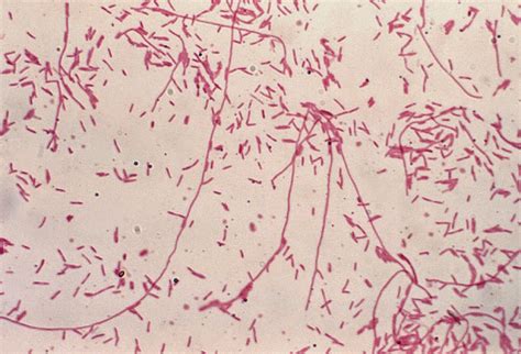 Miscellaneous Gram Negative Bacteria Tuyenlab