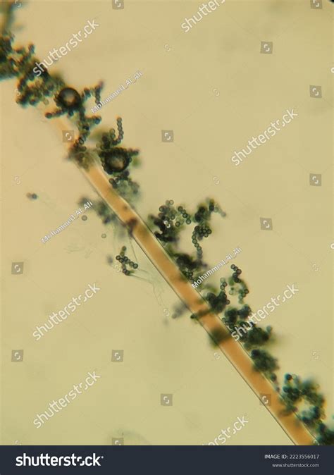 Photo Fungi Mycelia Spores Under Microscope Stock Photo 2223556017