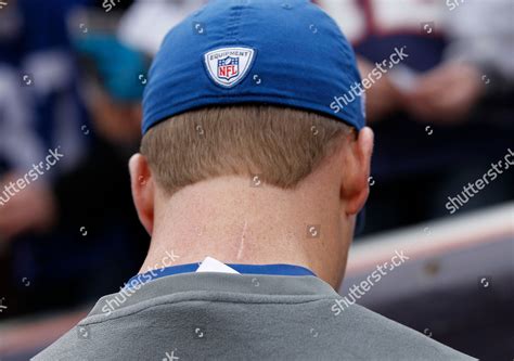 Peyton Manning Scar Neck Surgery On Editorial Stock Photo Stock Image