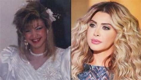 نوال تتخلّص من عمليّات التجميل من ناحية أخرى، بدت نوال الزغبي بلوك مختلف خلال الفترة الماضية بعد أن تخلّصت من آثار عمليات التجميل في وجهها، وفور نشرها صورها الخاصة من أحدث حفلاتها الغنائية قبل أيام، إنهالت تعليقات الجمهور بأن نوال صارت أجمل بدون البوتوكس. بسبب فضيحة "عمليات التجميل".. نجمات غاضبات ويهددن بالقضاء ...