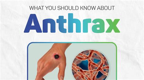 What You Need To Know About Anthrax Hci Healthcare Limited