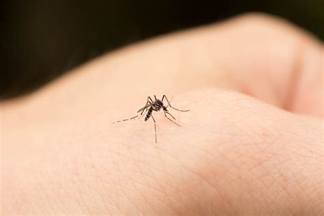 How To Stop Mosquito Bites From Itching
