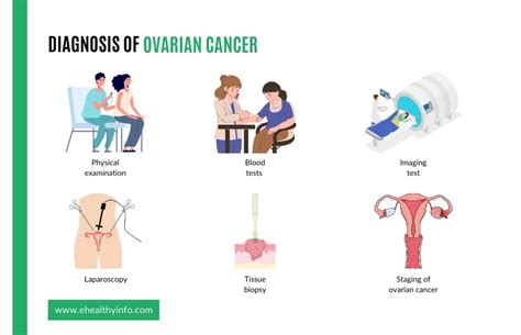 Ovarian Cancer Symptoms Treatment Surgery And Screening