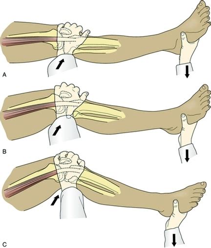 Sports Injury Bulletin Diagnose Treat The Controversial