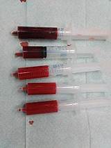 Arterial Blood Gas Kit Images