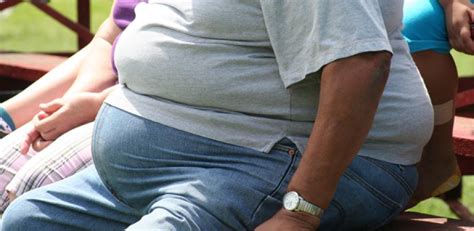 Obesity Linked To Premature Death With Greatest Effect In Men