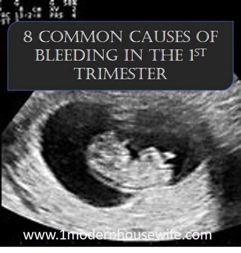 Cramping And Bleeding First Trimester Hiccups Pregnancy