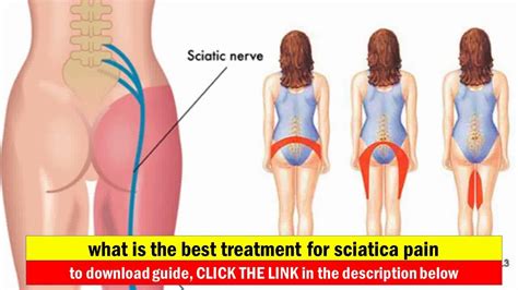 Here's how to get started at home. sciatica pain in leg - back and leg pain: how to quickly ...