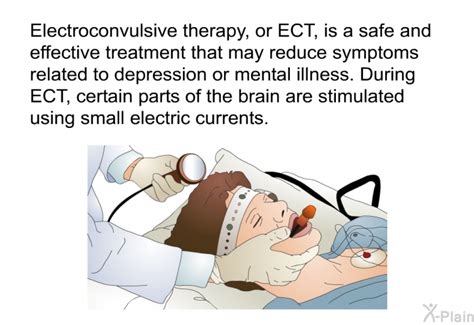 Electroconvulsive Therapy Ect
