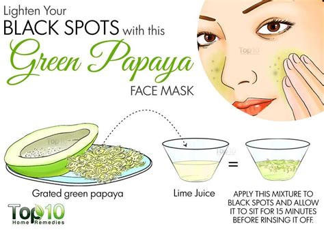 10 Home Remedies To Get Rid Of Dark Spots On Face Top 10 Home