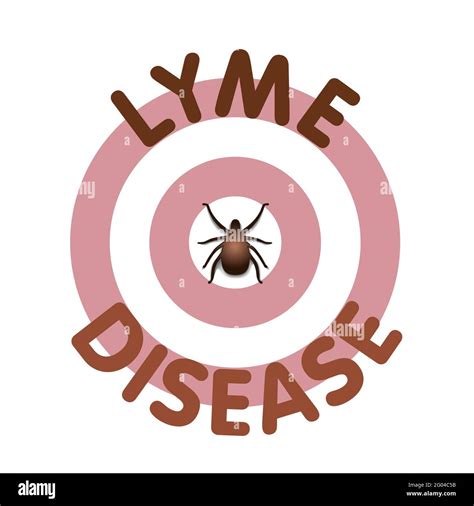 Lyme Disease Tick Bite Bulls Eye Rash Infection Borrelia