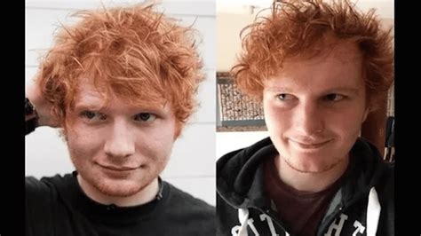 La Triste Vida Del Döppelganger De Ed Sheeran