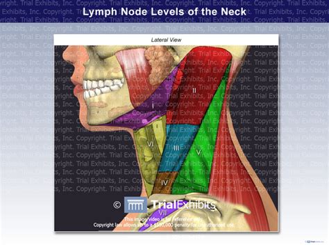 Lymph Node Levels Of The Neck Trial Exhibits Inc