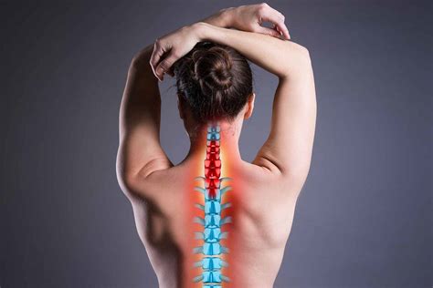 Prolapsed Or Herniated Disc In The Neck Blackberry Clinic Blog